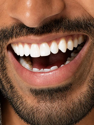Dents et gencives