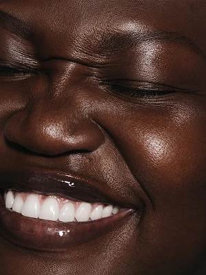 Sourire et esthétique